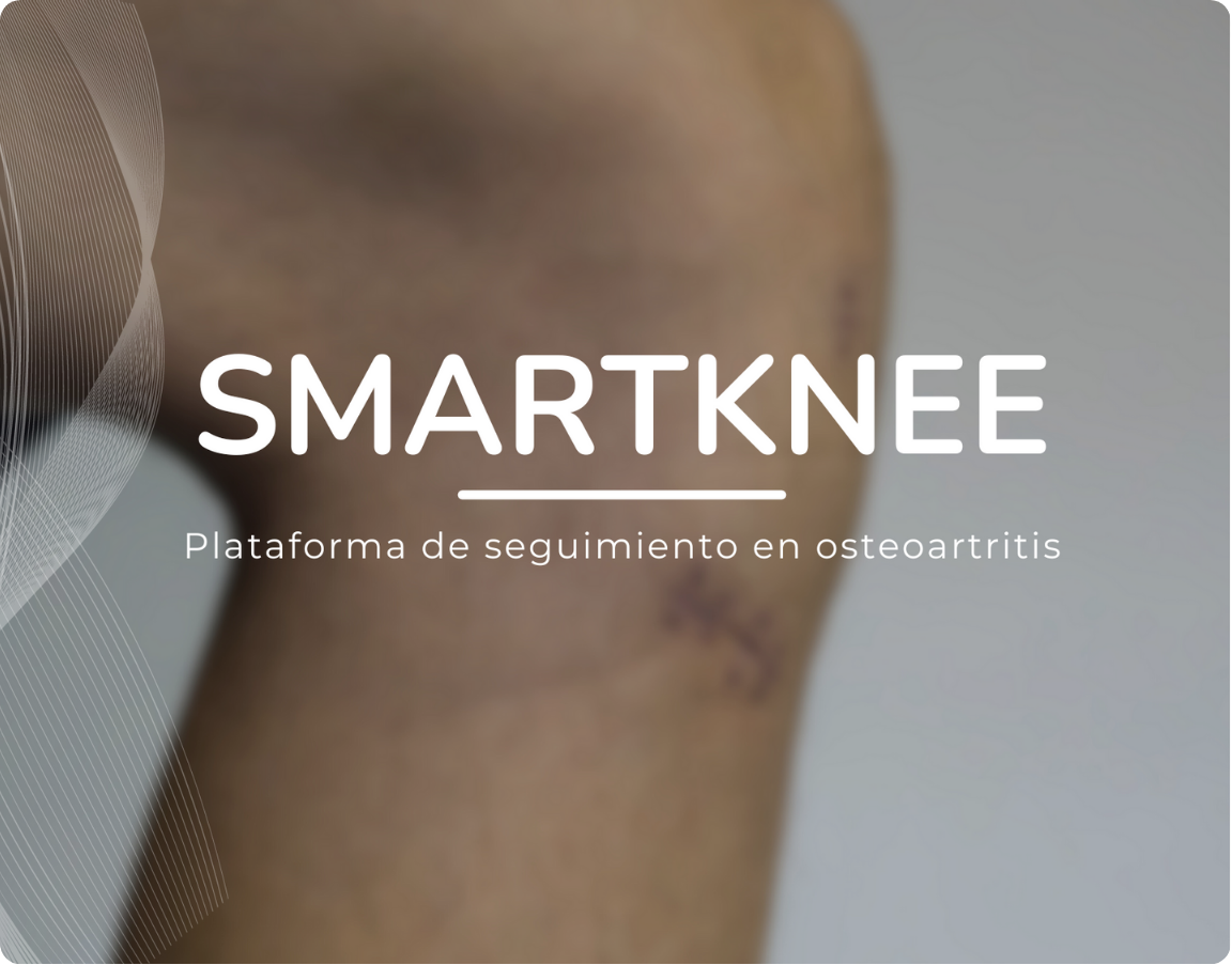 Smartkenee